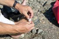 Managing Blisters While Hiking